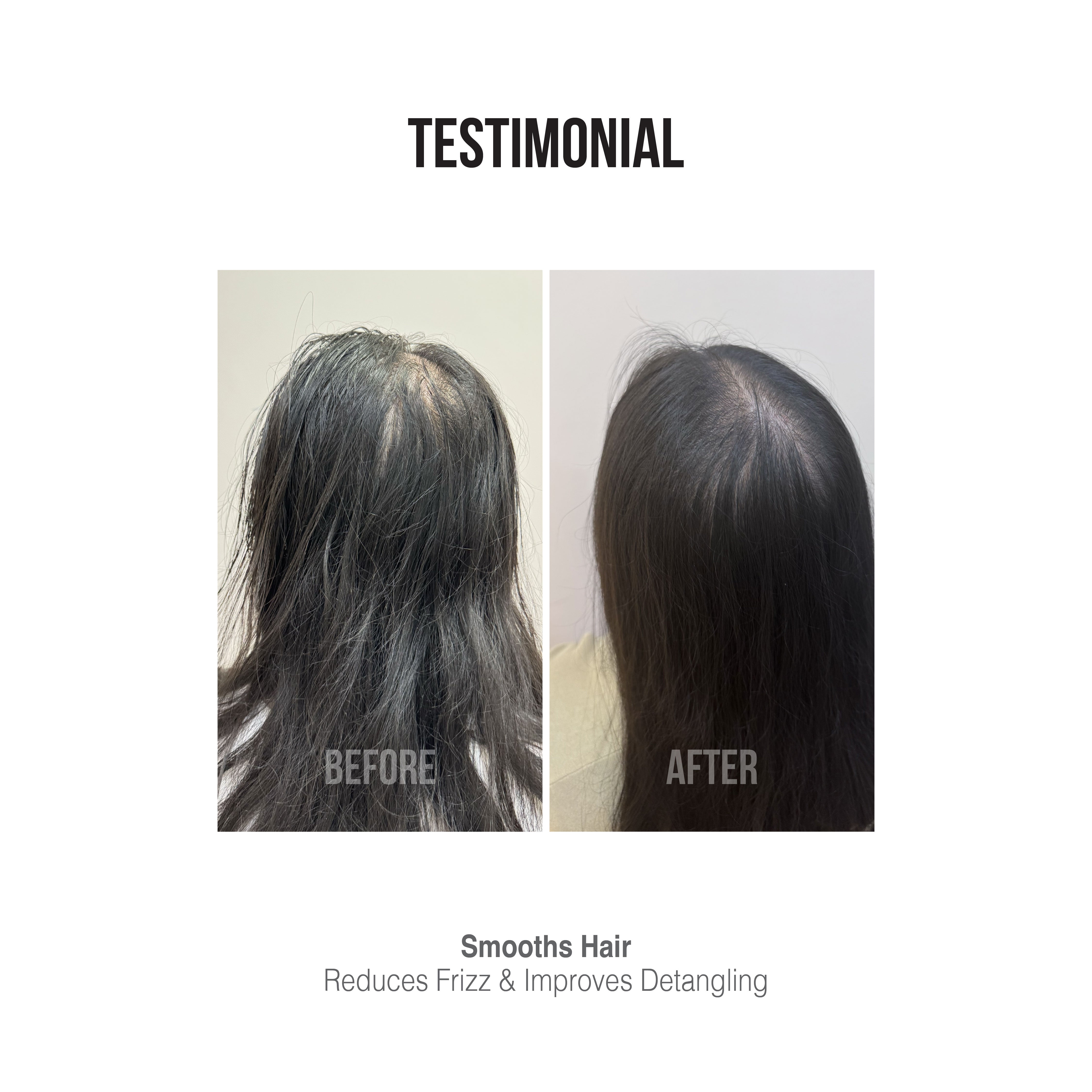 [DR CHONG CLINIC] Follicle Vitality Shampoo 300ml | All Hair Types | Deep Cleansing | Refreshes Scalp | Hair growth