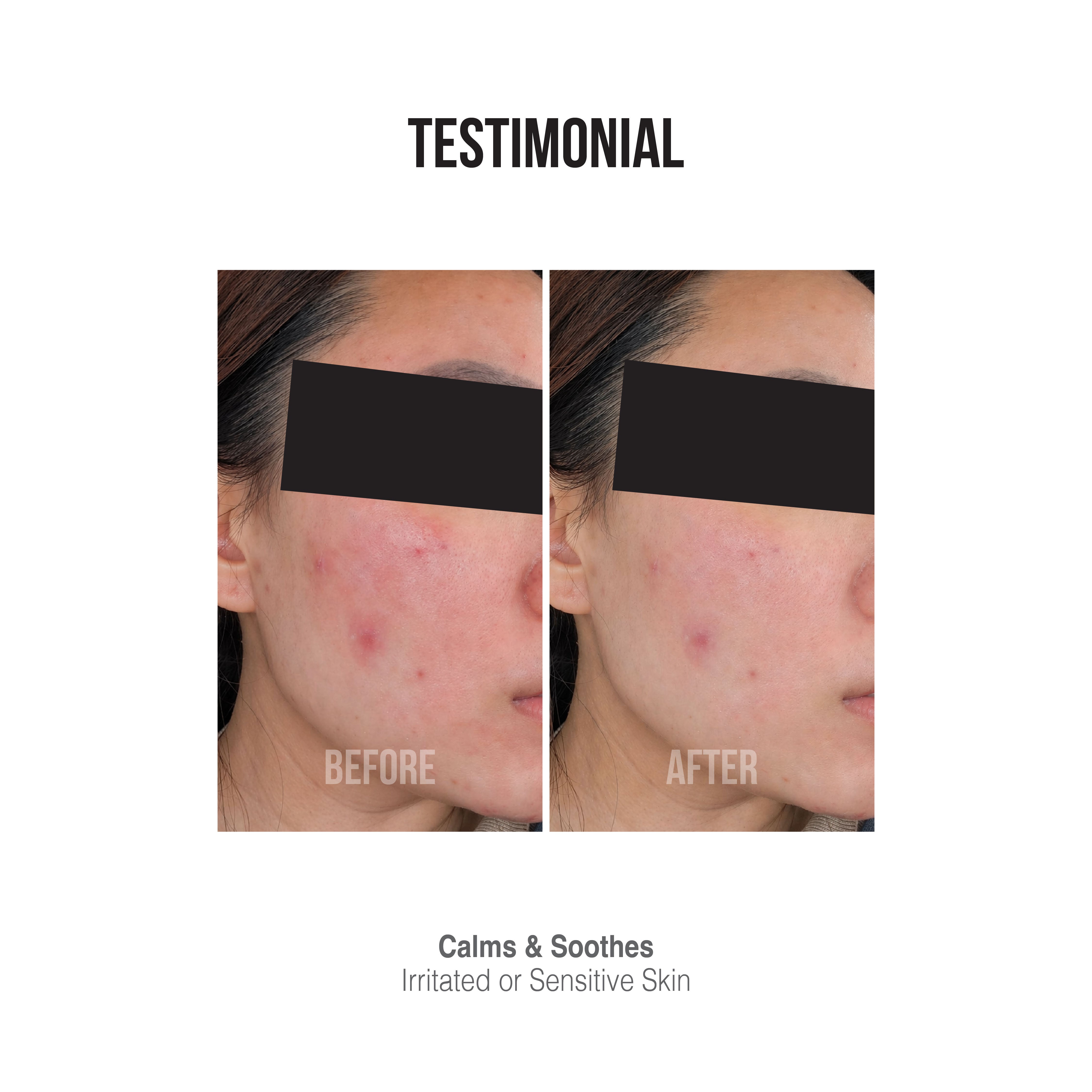 [DR CHONG CLINIC] Dreamskin Light Mask – Post-Treatment Soothing Face Mask | Reduce Redness & Repair Skin Barrier