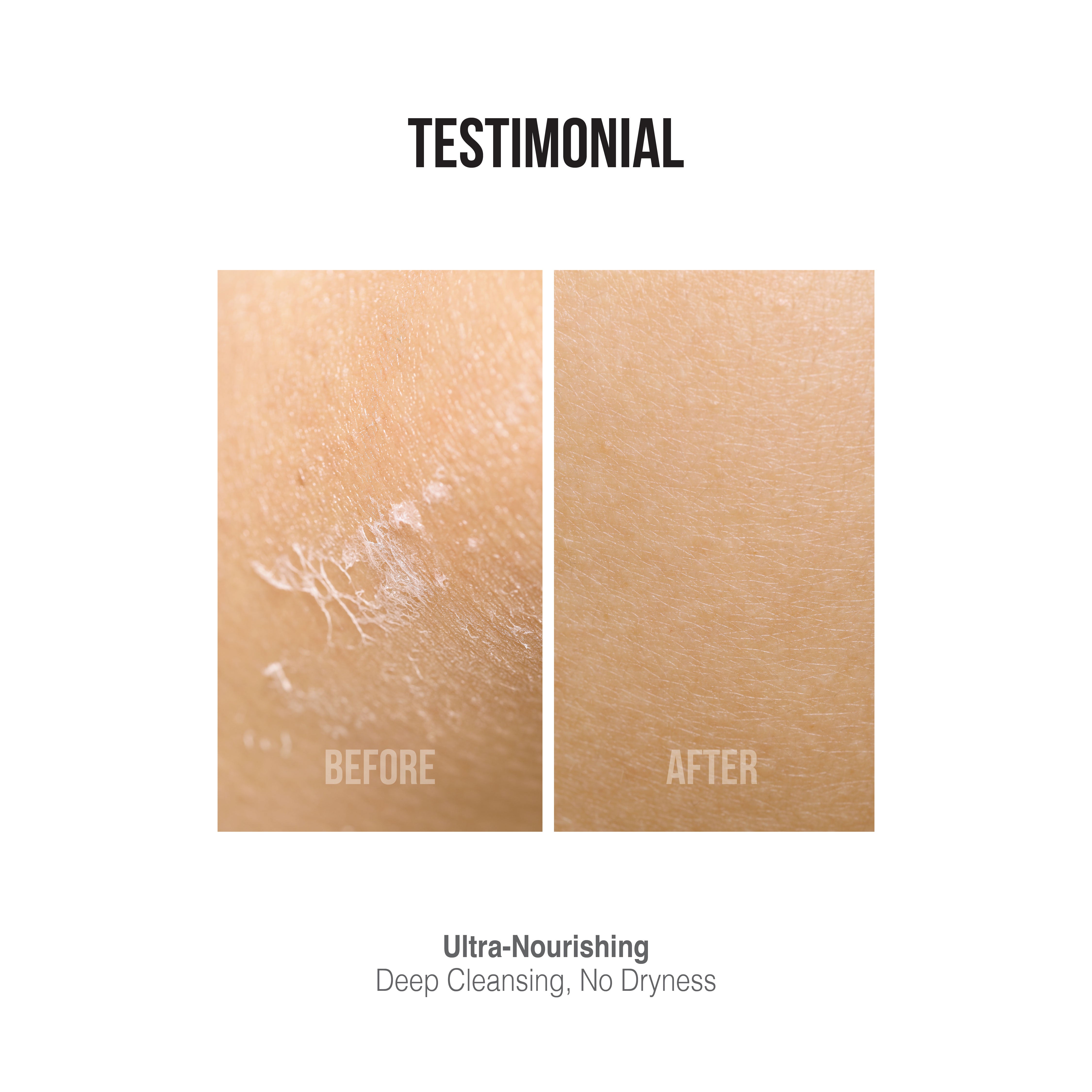[DR CHONG CLINIC] Dreamskin Shower Oil 250 ml | Nourishing | Rejuvenating | Soothing | Deep cleansing | Sweet Almond